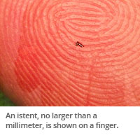 close-up view of an iStent